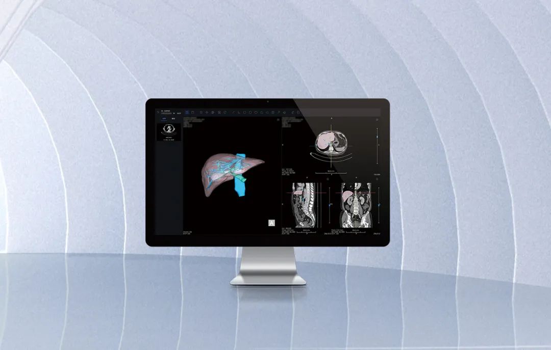 北京市首款！海杰亞醫(yī)療自主研發(fā)的AI+肝臟CT影像處理軟件獲批上市！